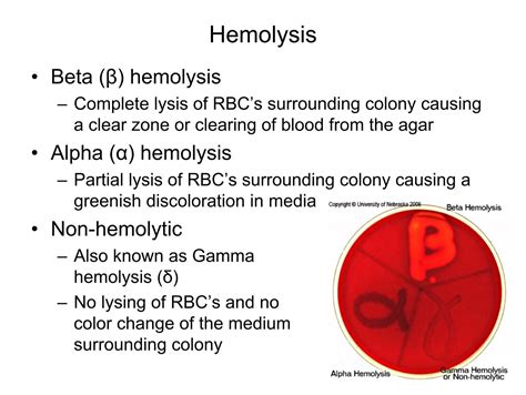 beta vs alpha hemolytic|Alpha Hemolysis vs. Beta Hemolysis — What's the .